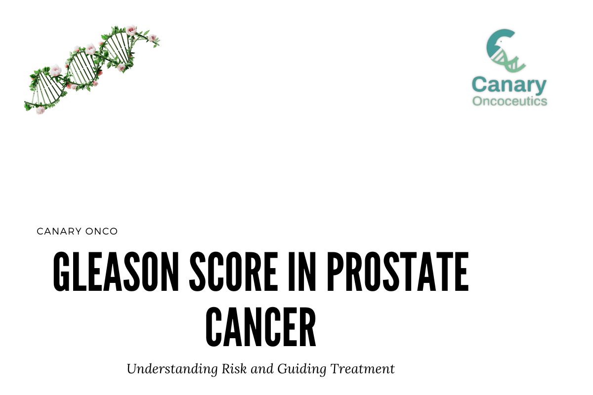 Gleason Score in Prostate Cancer